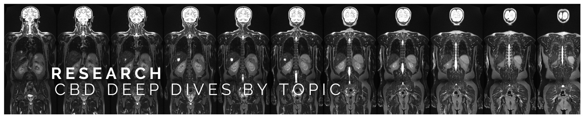 CBD, or cannabidiol, has become a focal point in medical research due to its wide-ranging potential impacts across various body systems and health issues. Deep dives into CBD research reveal its multifaceted nature, addressing diverse topics from mental health to chronic pain management. These extensive studies explore how CBD interacts with the body's endocannabinoid system, a complex network influencing numerous physiological processes.

One key area of CBD research focuses on neurological health. Studies have examined CBD's potential in treating conditions like epilepsy, anxiety, and depression, given its neuroprotective properties. Another significant research domain is CBD's role in pain management, particularly for chronic conditions like arthritis and multiple sclerosis, where it's thought to reduce inflammation and alleviate pain.

Additionally, CBD research has expanded into areas like cardiovascular health, examining its potential to influence heart rate and blood pressure. Its anti-inflammatory and antioxidative properties suggest a beneficial role in heart health and metabolic processes.

Furthermore, CBD's impact on the gastrointestinal system, including its potential to ease symptoms of inflammatory bowel diseases, represents another promising research avenue. These deep dives into CBD's effects across body systems highlight its potential as a versatile, natural therapeutic agent.

Overall, CBD research spans a broad spectrum of health issues, offering insights into its potential as a holistic treatment option. This ongoing research is crucial for understanding CBD's full therapeutic potential across various body systems.